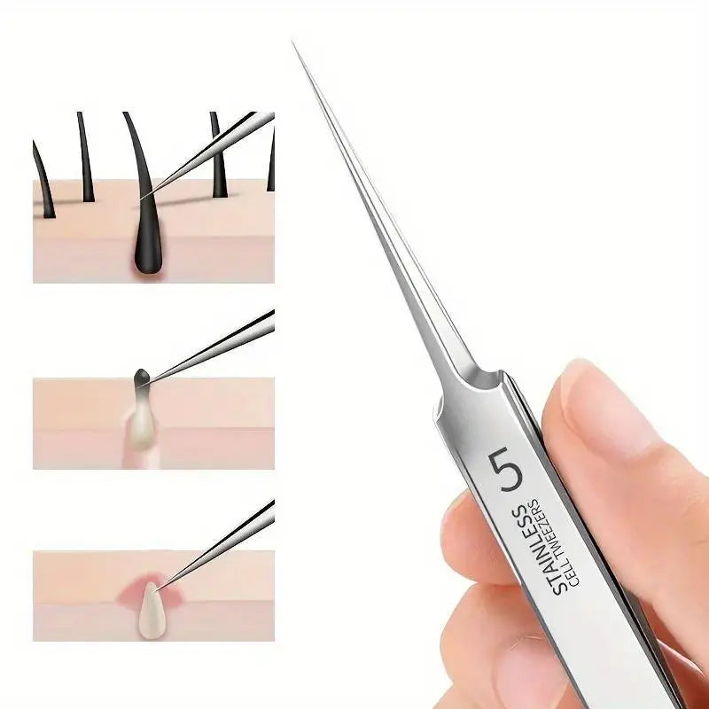 Fine Tweezers For Removing Blackheads And Acne, Stainless Steel, Suitable For All Skin Types, No Fragrance