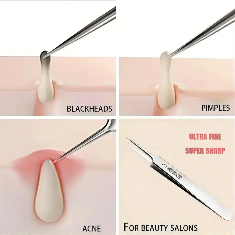 Fine Tweezers For Removing Blackheads And Acne, Stainless Steel, Suitable For All Skin Types, No Fragrance